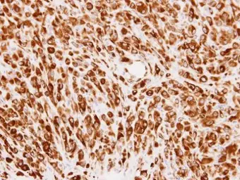 Anti-PMM2 antibody [N1C3] used in IHC (Paraffin sections) (IHC-P). GTX114049