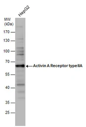 Anti-Activin Receptor Type IIA antibody [C1C3] used in Western Blot (WB). GTX114053