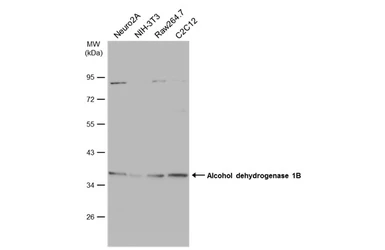 Anti-Alcohol dehydrogenase 1B antibody [N2C3] used in Western Blot (WB). GTX114054