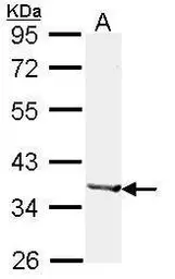 Anti-Alcohol dehydrogenase 1B antibody [N2C3] used in Western Blot (WB). GTX114054