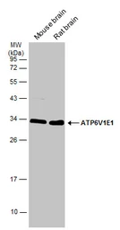 Anti-ATP6V1E1 antibody used in Western Blot (WB). GTX114056