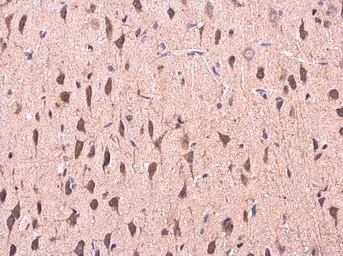 Anti-COMT antibody used in IHC (Paraffin sections) (IHC-P). GTX114062