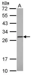 Anti-COMT antibody used in Western Blot (WB). GTX114062