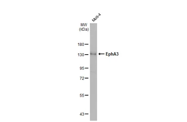 Anti-EphA3 antibody [N1N3] used in Western Blot (WB). GTX114067