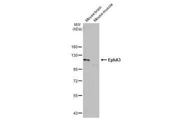 Anti-EphA3 antibody [N1N3] used in Western Blot (WB). GTX114067
