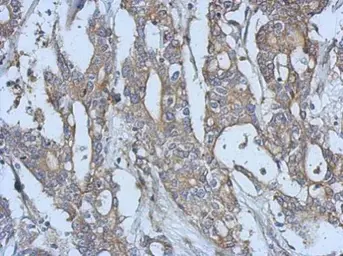 Anti-EphA3 antibody [N1N3] used in IHC (Paraffin sections) (IHC-P). GTX114067