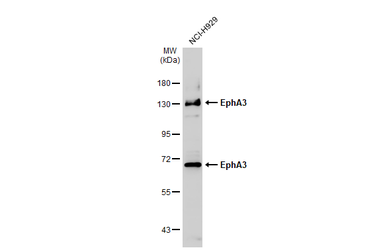 Anti-EphA3 antibody [N1N3] used in Western Blot (WB). GTX114067