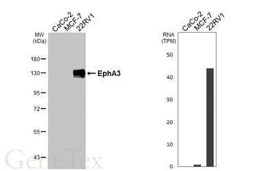 Anti-EphA3 antibody [N1N3] used in Western Blot (WB). GTX114067