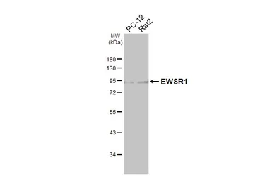 Anti-EWSR1 antibody used in Western Blot (WB). GTX114069