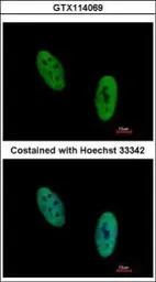 Anti-EWSR1 antibody used in Immunocytochemistry/ Immunofluorescence (ICC/IF). GTX114069