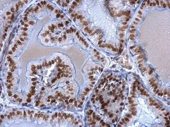 Anti-EWSR1 antibody used in IHC (Paraffin sections) (IHC-P). GTX114069