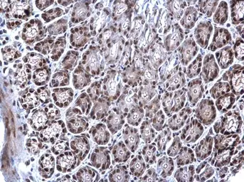 Anti-EWSR1 antibody used in IHC (Paraffin sections) (IHC-P). GTX114069