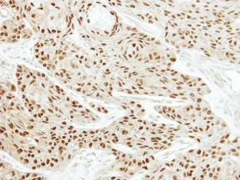 Anti-EWSR1 antibody used in IHC (Paraffin sections) (IHC-P). GTX114069