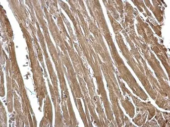 Anti-FHL2 antibody used in IHC (Paraffin sections) (IHC-P). GTX114071