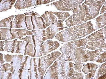 Anti-FHL2 antibody used in IHC (Paraffin sections) (IHC-P). GTX114071