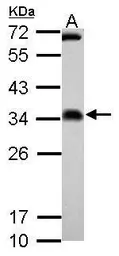 Anti-FHL2 antibody used in Western Blot (WB). GTX114071