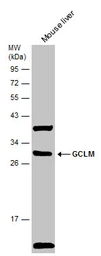 Anti-GCLM antibody used in Western Blot (WB). GTX114075