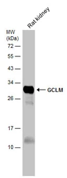 Anti-GCLM antibody used in Western Blot (WB). GTX114075