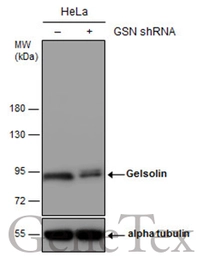 Anti-Gelsolin antibody used in Western Blot (WB). GTX114078