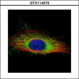 Anti-Gelsolin antibody used in Immunocytochemistry/ Immunofluorescence (ICC/IF). GTX114078