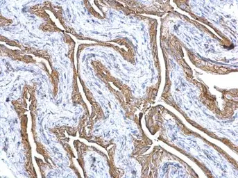 Anti-Gelsolin antibody used in IHC (Paraffin sections) (IHC-P). GTX114078