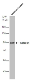Anti-Gelsolin antibody used in Western Blot (WB). GTX114078