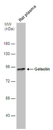 Anti-Gelsolin antibody used in Western Blot (WB). GTX114078