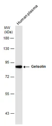 Anti-Gelsolin antibody used in Western Blot (WB). GTX114078