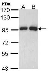 Anti-Gelsolin antibody used in Western Blot (WB). GTX114078