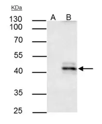 Anti-HLA-A antibody [N1C2] used in Immunoprecipitation (IP). GTX114080