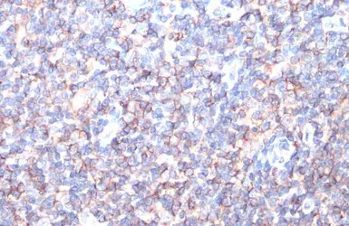 Anti-HLA-A antibody [N1C2] used in IHC (Paraffin sections) (IHC-P). GTX114080