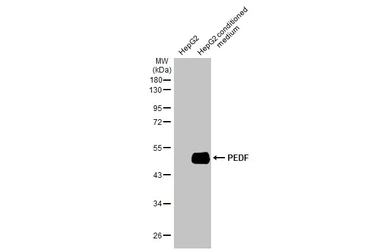 Anti-PEDF antibody [N1C2] used in Western Blot (WB). GTX114097