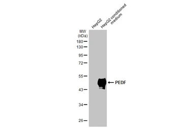 Anti-PEDF antibody [N1C2] used in Western Blot (WB). GTX114097