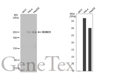 Anti-ROBO1 antibody used in Western Blot (WB). GTX114103