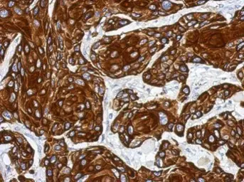 Anti-Cytokeratin 17 antibody used in IHC (Paraffin sections) (IHC-P). GTX114112