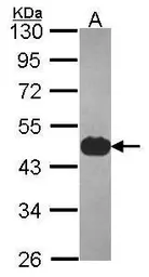 Anti-Cytokeratin 17 antibody used in Western Blot (WB). GTX114112