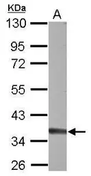 Anti-TREX1 antibody used in Western Blot (WB). GTX114123