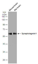 Anti-Synaptotagmin 1 antibody [N1C2] used in Western Blot (WB). GTX114124