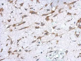 Anti-UGT1A antibody [C1C3] used in IHC (Paraffin sections) (IHC-P). GTX114128