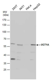 Anti-UGT1A antibody [C1C3] used in Western Blot (WB). GTX114128