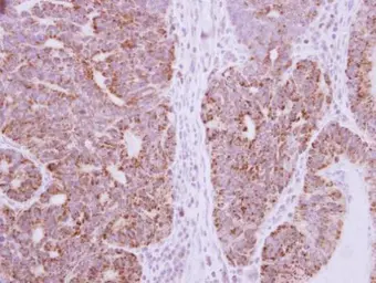 Anti-DcR3 antibody used in IHC (Paraffin sections) (IHC-P). GTX114130