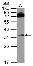 Anti-DcR3 antibody used in Western Blot (WB). GTX114130