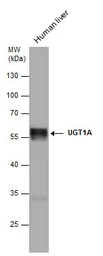 Anti-UGT1A antibody used in Western Blot (WB). GTX114131