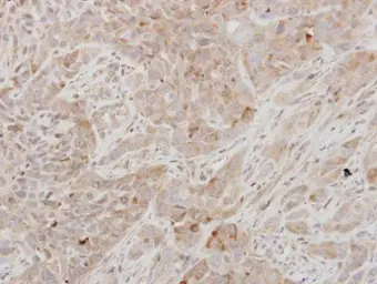 Anti-Prolactin antibody [N1C3] used in IHC (Paraffin sections) (IHC-P). GTX114138