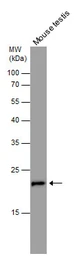 Anti-RAN antibody used in Western Blot (WB). GTX114139