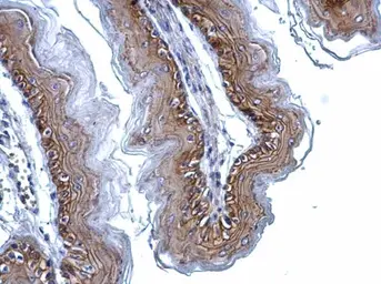 Anti-gamma Catenin antibody [C2C3], C-term used in IHC (Paraffin sections) (IHC-P). GTX114156