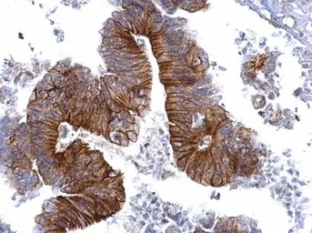 Anti-gamma Catenin antibody [C2C3], C-term used in IHC (Paraffin sections) (IHC-P). GTX114156