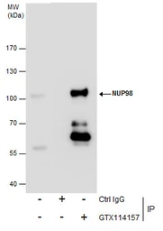 Anti-NUP98 antibody [N3C1], Internal used in Immunoprecipitation (IP). GTX114157