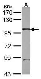 Anti-NUP98 antibody [N3C1], Internal used in Western Blot (WB). GTX114157