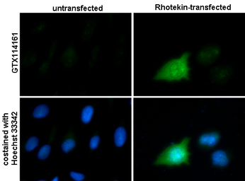 Anti-Rhotekin antibody used in Immunocytochemistry/ Immunofluorescence (ICC/IF). GTX114161